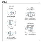 WASHBON MOLAR BANDS  ΟΡΘΟΔΟΝΤΙΚΑ