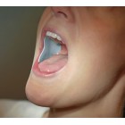 DRYDENT PAROTID  ΟΔΟΝΤΙΑΤΡΙΚΑ
