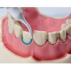 RETRACTION PASTE 